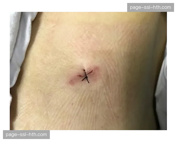 神秘人老将埃琳娜-德尔-多恩完成肩部手术,恢复顺利 神秘人老将埃琳娜-德尔-多恩完成肩部手术,恢复顺利